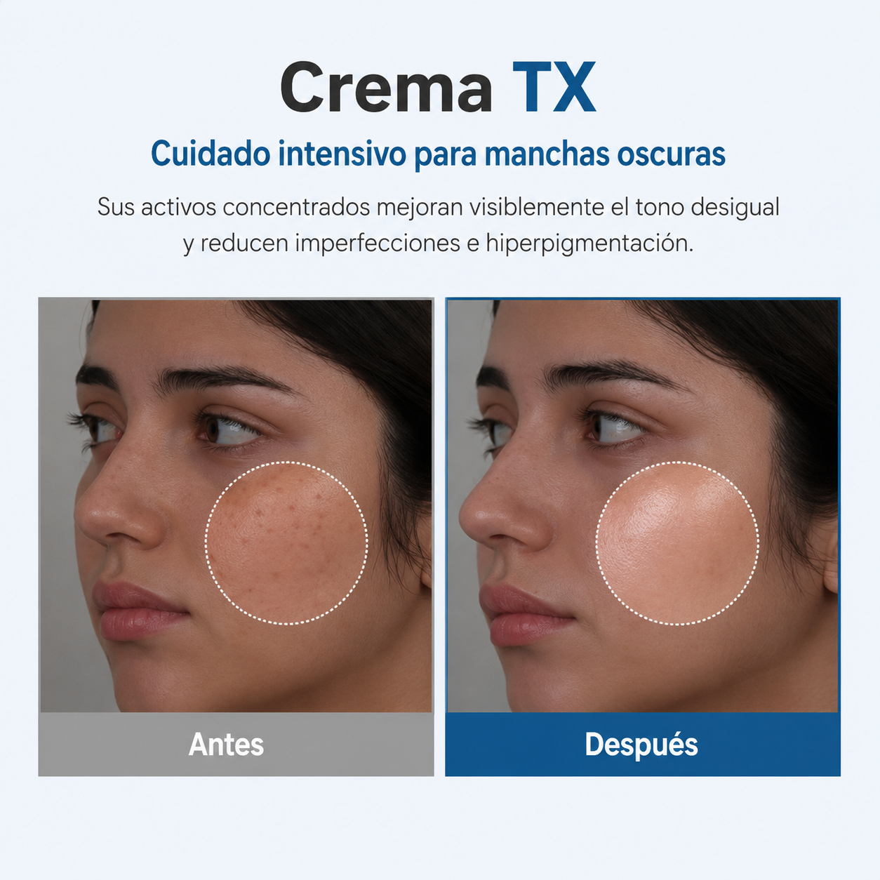 Crema Anti Manchas