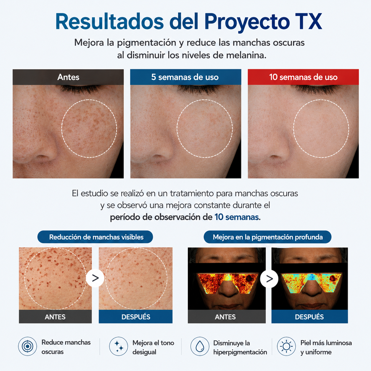 Crema Anti Manchas