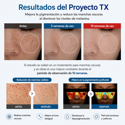 Crema Anti Manchas